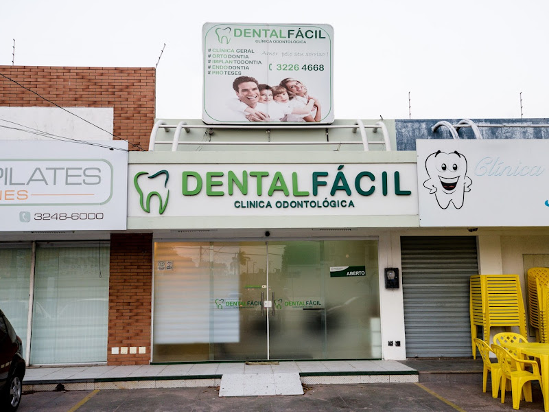 Foto 10 de Dental Clean – Implantes Dentários, Facetas em Resina e Lentes de Contato Dental