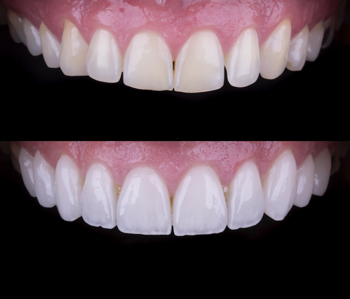 Foto 5 de Dental Esthetic Center