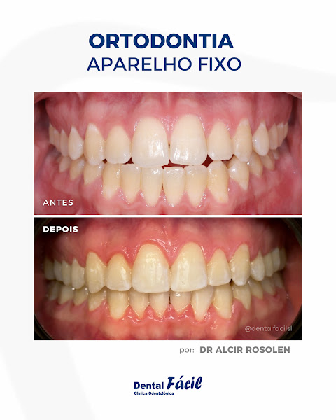 Foto 3 de Dental Fácil