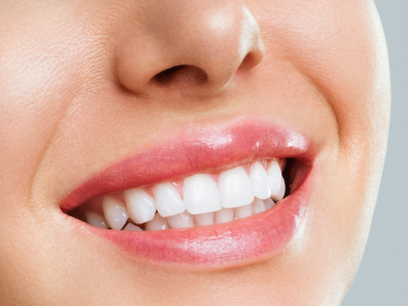 Foto 6 de Dental Prime