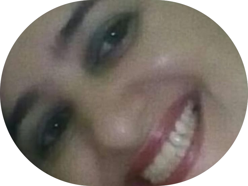 Foto 2 de Dental Sorrir - Pau Amarelo