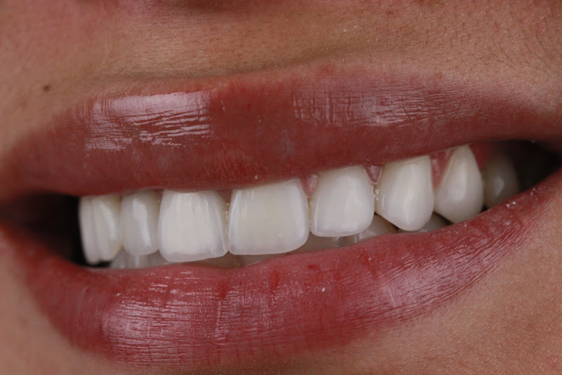 Foto 3 de Dental System