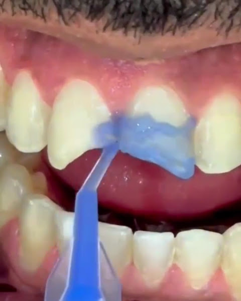 Foto 3 de Dental Vita Implantes Dentários e Reabilitação Oral em Franca