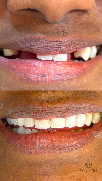 Foto 2 de DentalClin