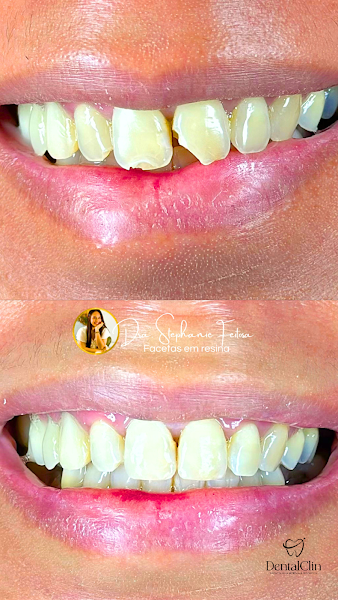 Foto 3 de DentalClin