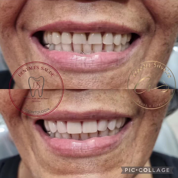 Foto 4 de Dentales Saúde - Centro Sete Lagoas- MG e região