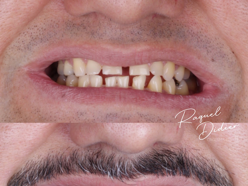 Foto 15 de DentALL consultório odontológico