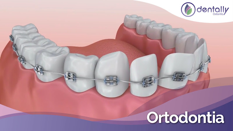 Foto 3 de Dentally Odonto