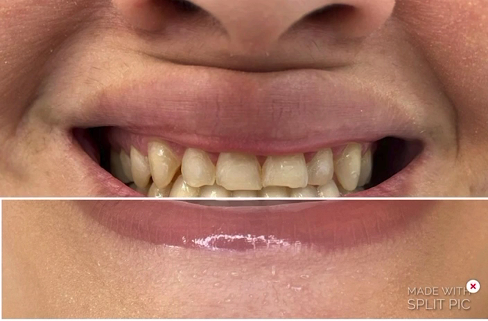 Foto 5 de Dentals Odontologia