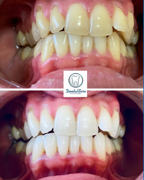Foto 2 de DENTALSERV CLÍNICA ODONTOLÓGICA