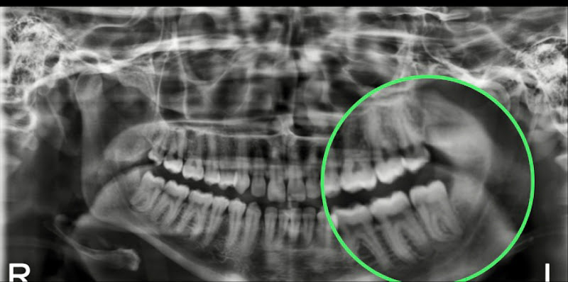 Foto 3 de DENTALSERV CLÍNICA ODONTOLÓGICA