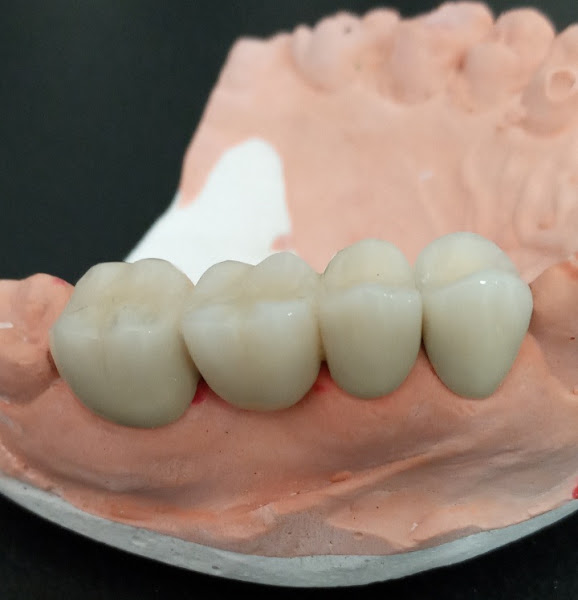 Foto de Dentão - Consultório Odontológico (Dr. Kleusson Muniz Pinheiro)