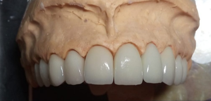 Foto 2 de Dentão - Consultório Odontológico (Dr. Kleusson Muniz Pinheiro)