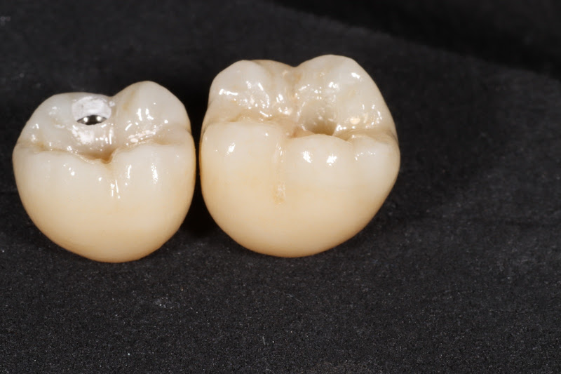 Foto 3 de Dentatech | Laboratório de Prótese Dentária Fluxo Digital em BH