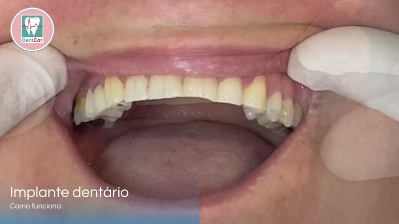 Foto 3 de DentCor | Clínica Médica e Odontológica em Santo André