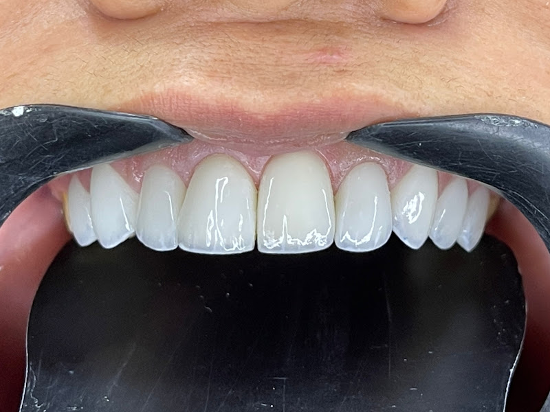 Foto 8 de Dente Life - Clínica Odontológica - Várzea Grande - MT - Jardim dos estados