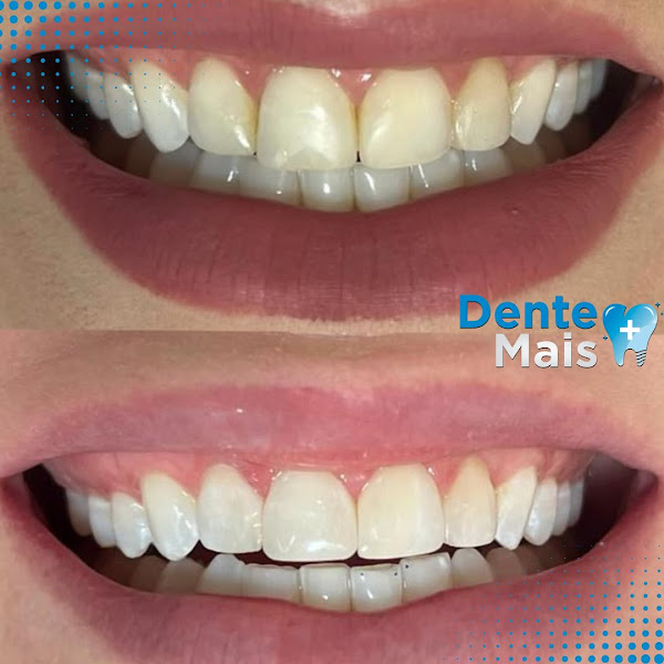 Foto 2 de Dente Mais