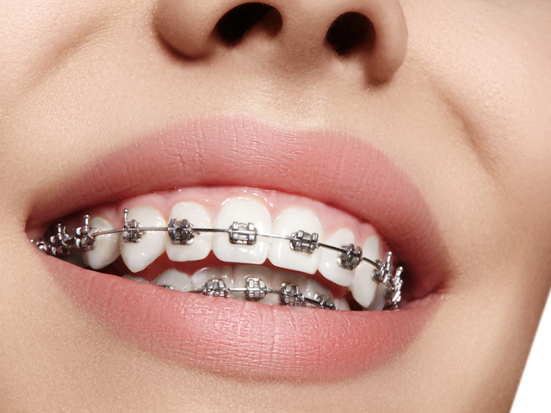 Foto 2 de Dente Mais Clínica