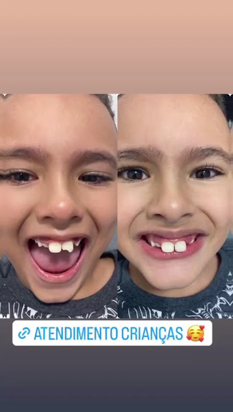 Foto 4 de Dente por Dente Clinica Odontológica