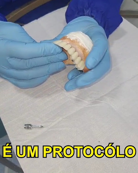 Foto 4 de Dente Sempre Implantes e Odontologia em Guarulhos
