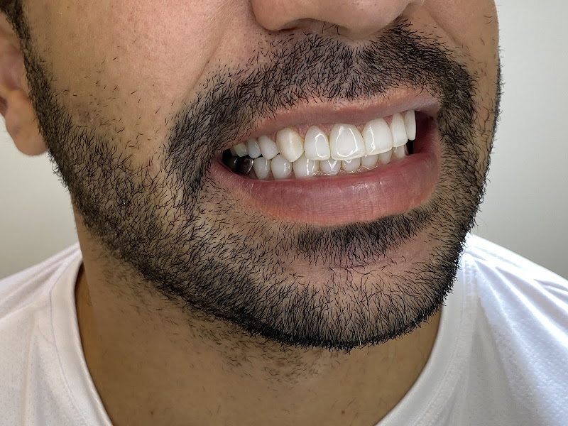 Foto 2 de Dente Sim - Odontologia Estética