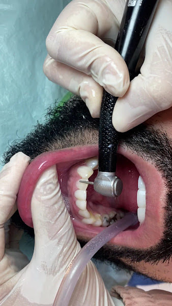 Foto 3 de Dente Sim - Odontologia Estética