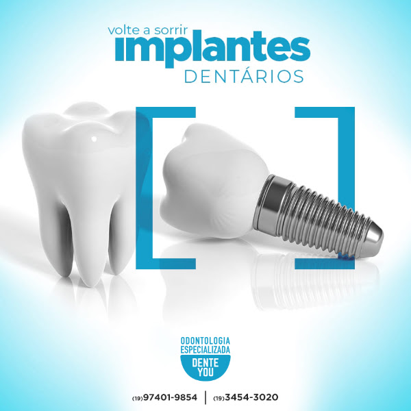 Foto 3 de Dente You - Odontologia Especializada