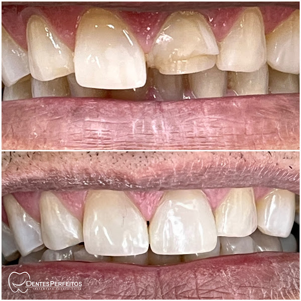 Foto 3 de Dentes Perfeitos Dentistas/Implante Dental/Ortodontia/HOF/Periodontia/Cirurgia/Prótese ao Lado de Madureira