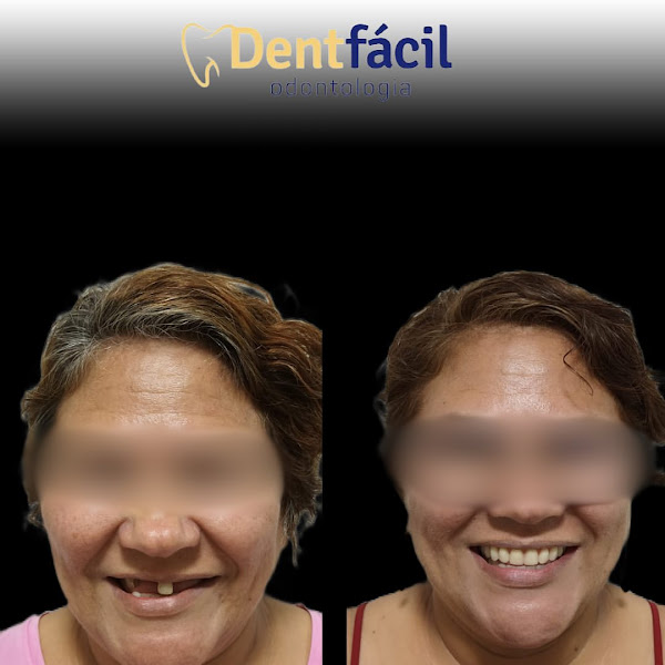 Foto 3 de Dentfácil