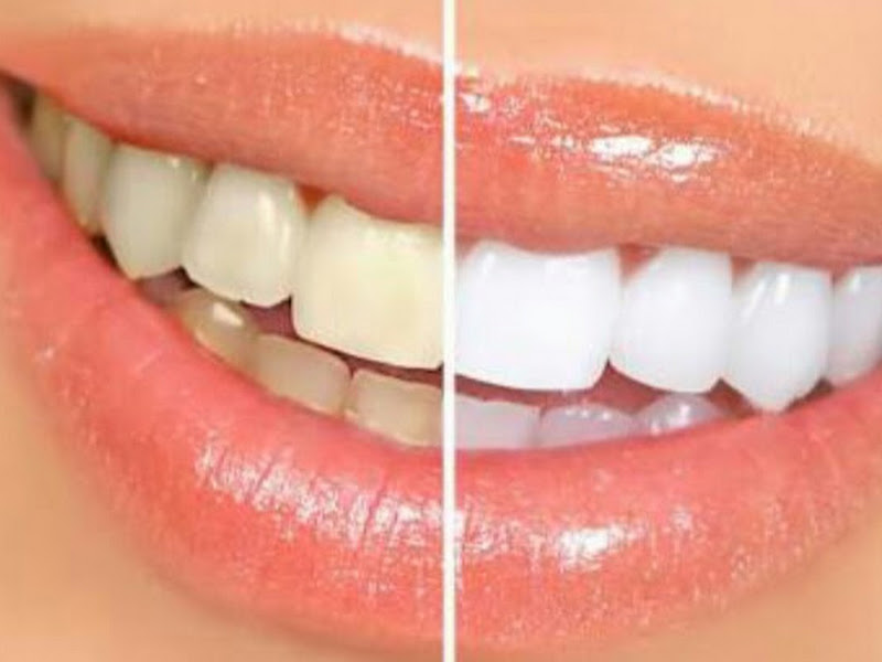 Foto 6 de DentGold Clínica Odontológica - Jabaquara