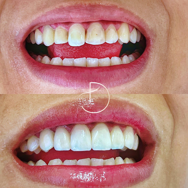 Foto 2 de Dentila Odontologia Especializada