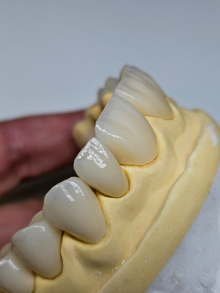 Foto 2 de Dentis Flow Laboratório de Prótese Dentária