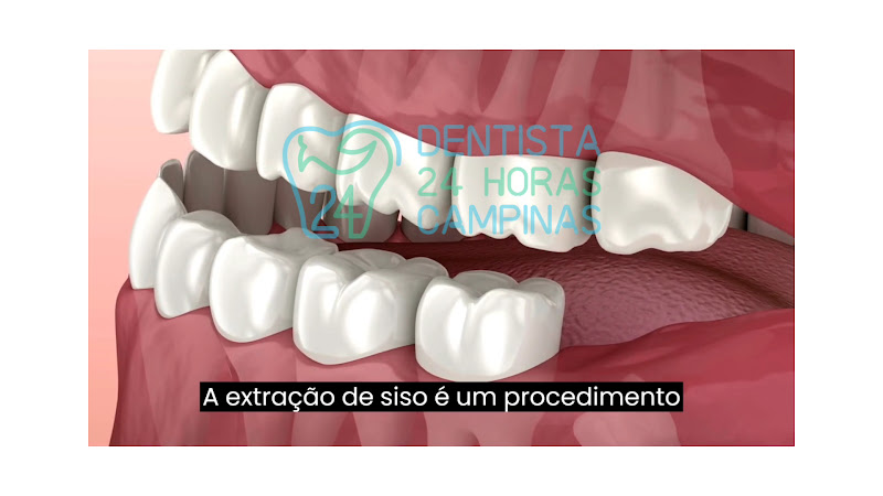 Foto 4 de Dentista 24 Horas Campinas