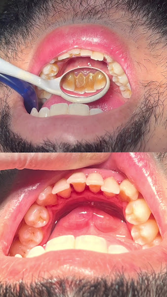 Foto 4 de Dentista 24 horas em João Pessoa - Dra.Lanna Lídia