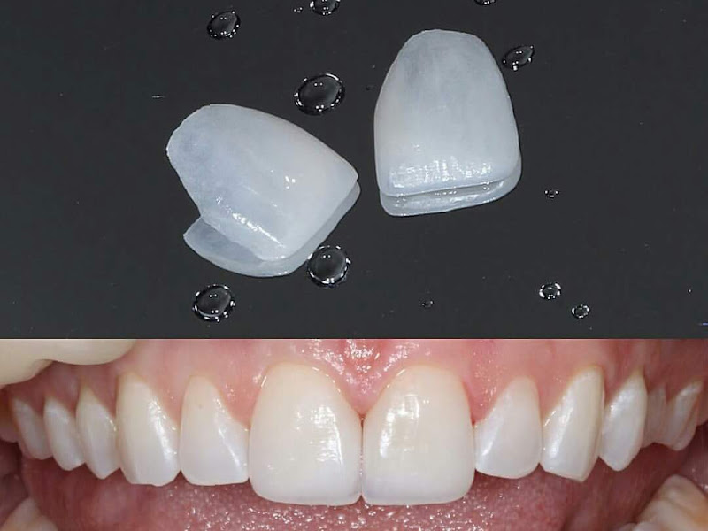 Foto 4 de Dentista 24 horas na Ceilândia Dr. João Carlos