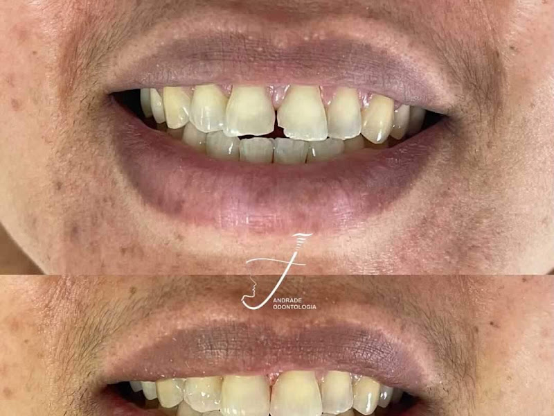 Foto 8 de Dentista 24 Horas-Odonto Andrades