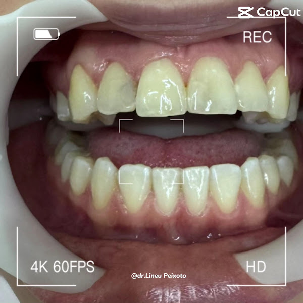 Foto 3 de Dentista 24 Horas Piracicaba Urgências