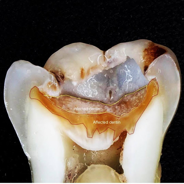 Foto 3 de Dentista 24 horas (por demanda) - SPB Odontologia