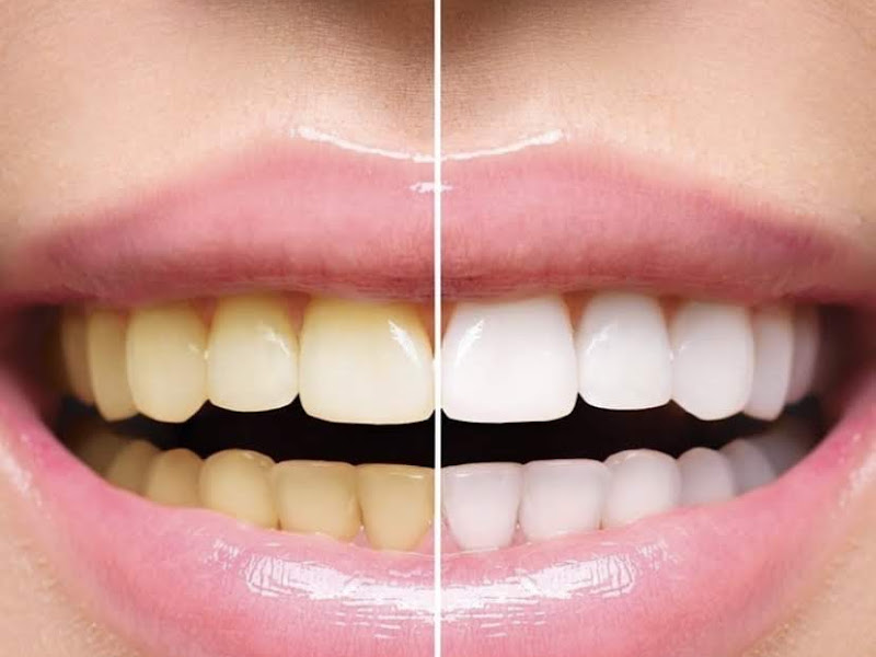 Foto 7 de Dentista 24h Bauru | AF Saúde Integrada | Dr. André Figadoli