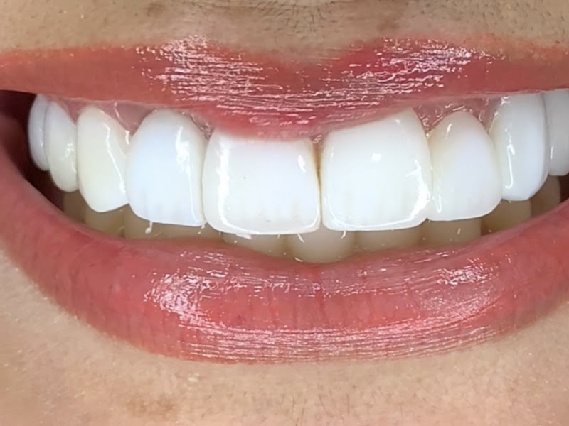 Foto 2 de Dentista 24h - Dr Adolpho Graça