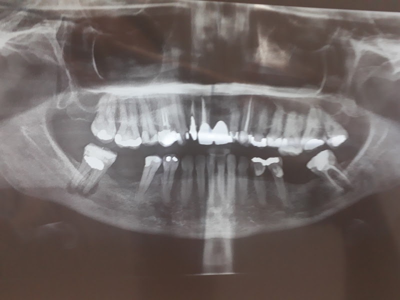 Foto 3 de DENTISTA 24H ( EMERGÊNCIAS)