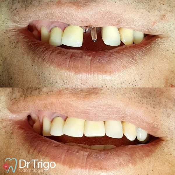 Foto 3 de Dentista 24H Rio Claro - Dr. Trigo