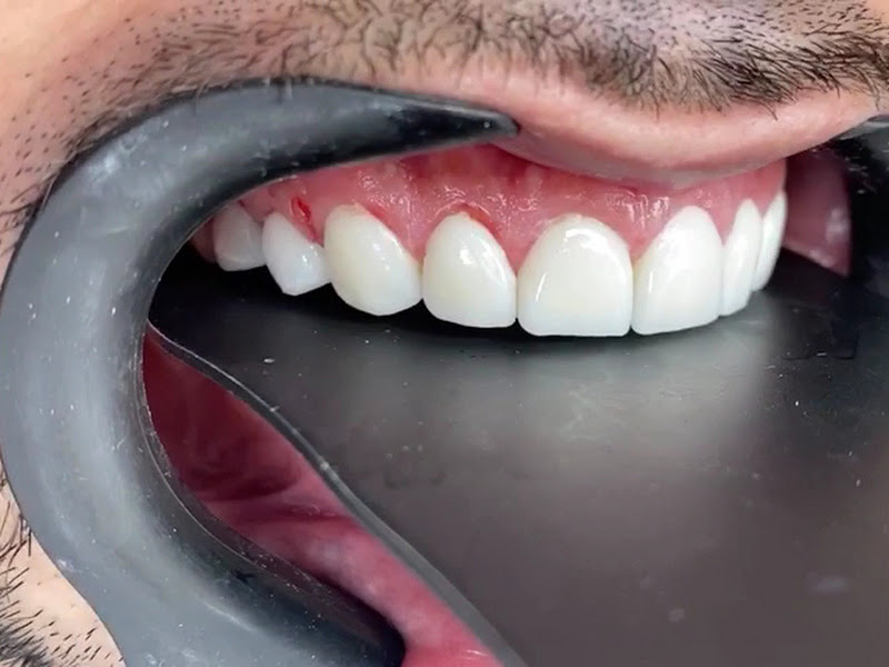 Foto 6 de Dentista 24horas ,Dor de dente - SBC