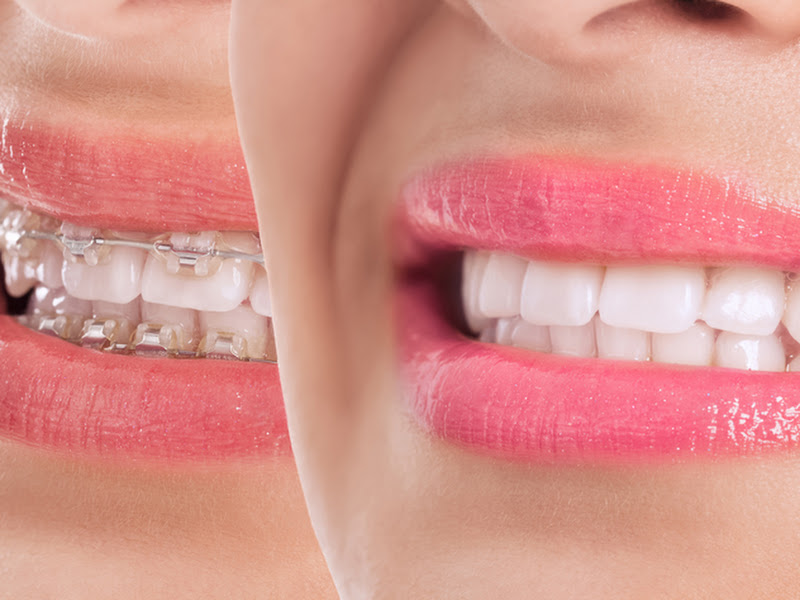 Foto 9 de Dentista 24hrs | Odonto Urgente Tatuapé