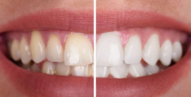 Foto 3 de Dentista 24hrs Recife (JV Odontologia Personalizada) Dra. Jessica Ventura