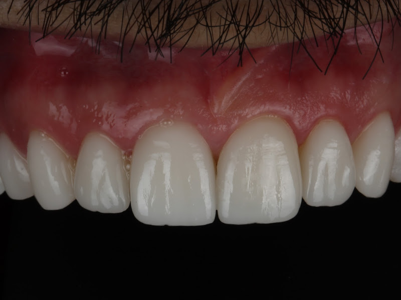 Foto 8 de Dentista 24hs - Dr. André Gusman | Urgência Odontológica