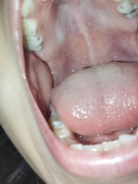 Foto 3 de Dentista 24HS Mogi das Cruzes🏥🚑