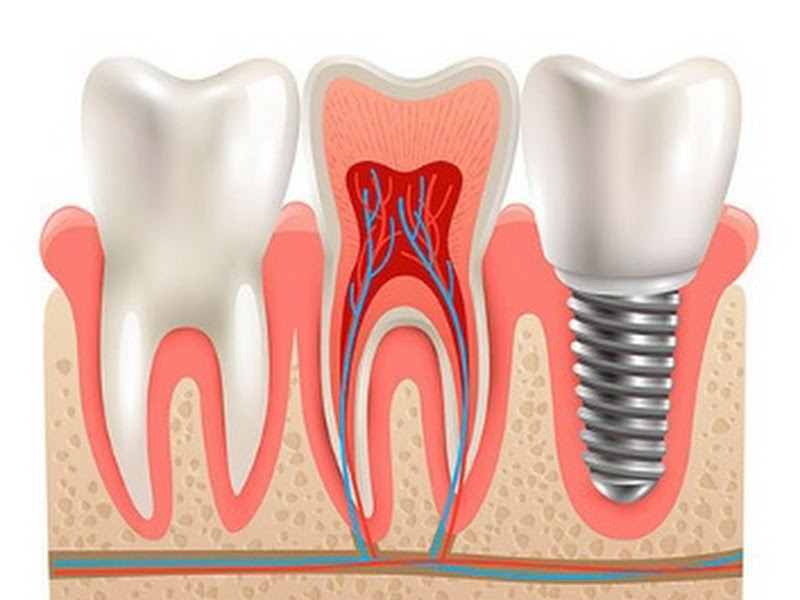 Foto 8 de Dentista Adriana Vale