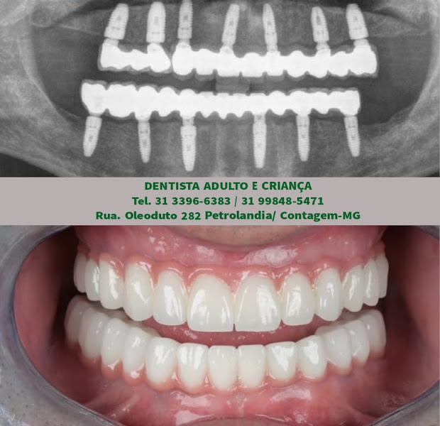 Foto 3 de Dentista Adulto e Criança