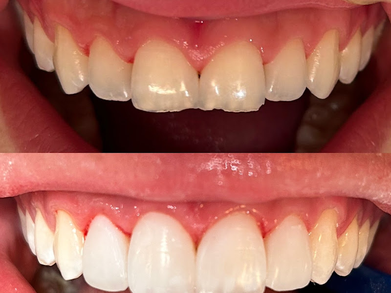 Foto 2 de Dentista Aldegir Tessaro
